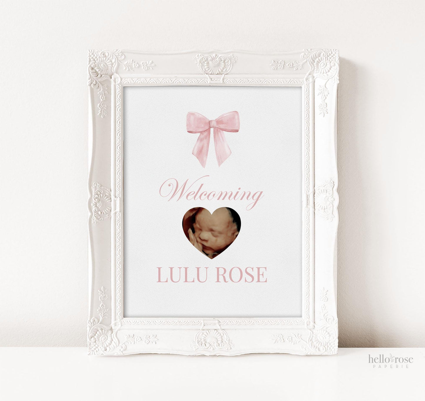 Welcoming Baby Pink Bow Baby Shower, Personalized Ultrasound Sonogram Sign, Girl Baby Bow Decor, Editable Template Digital Download TEMPLETT