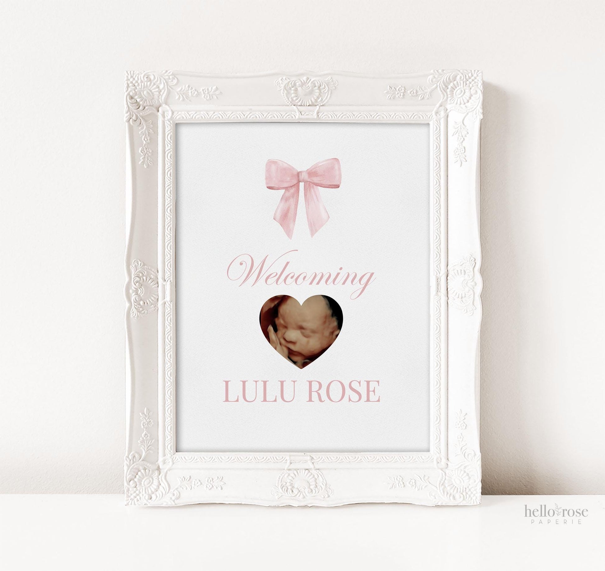 Welcoming Baby Pink Bow Baby Shower, Personalized Ultrasound Sonogram Sign, Girl Baby Bow Decor, Editable Template Digital Download TEMPLETT